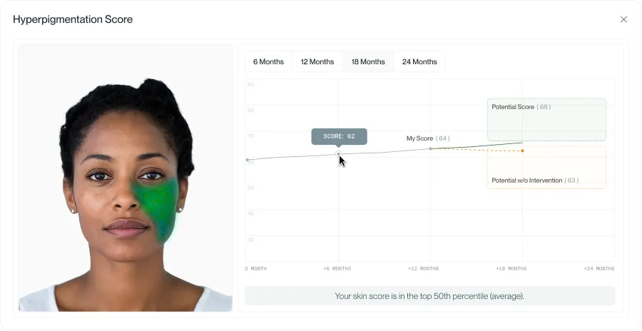 porphi dashboard: hyperpigmentation score over time with projections for potential improvement