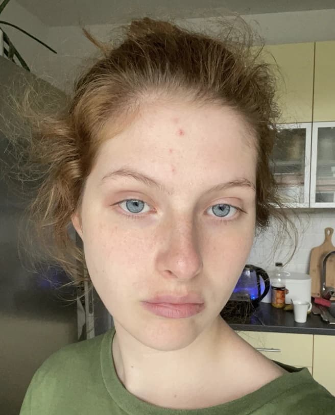 Transformation 1 — before