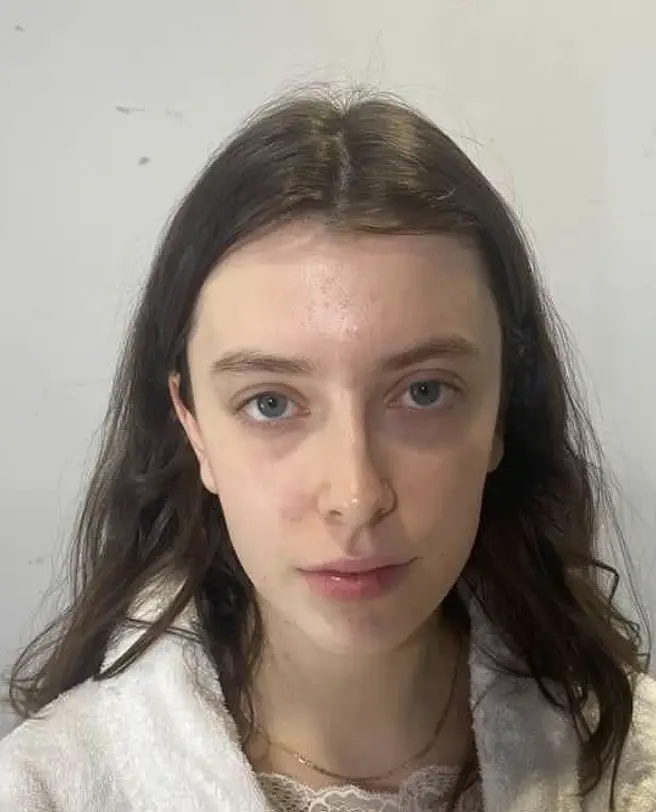 Transformation 3 — before