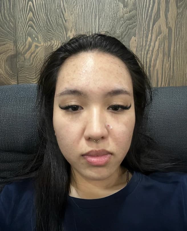 Transformation 7 — before